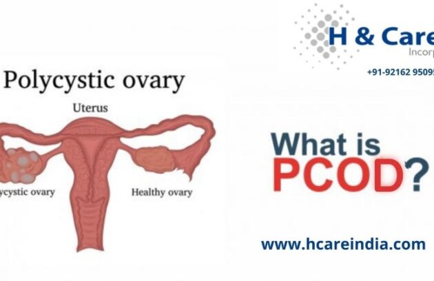 PCOD (Polycystic Ovary Disease)