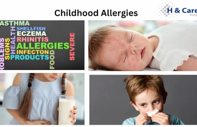 common childhood allergies: skin allergy, food allergy, seasonal allergy